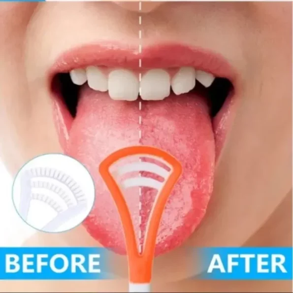 Tongue Cleaner Scraper Oral Tooth Brush